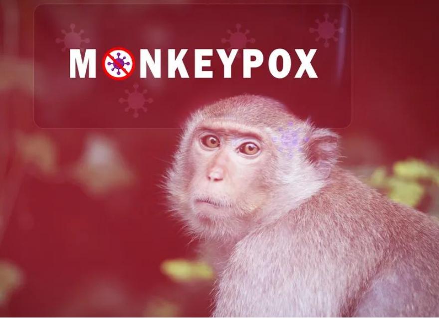 退退退！猴痘已入侵亞洲，糖友需警惕這些！